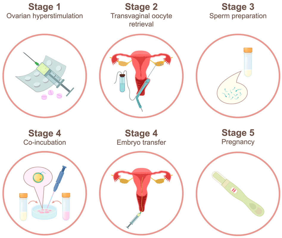 Egg Donor Process Stork Surrogacy International